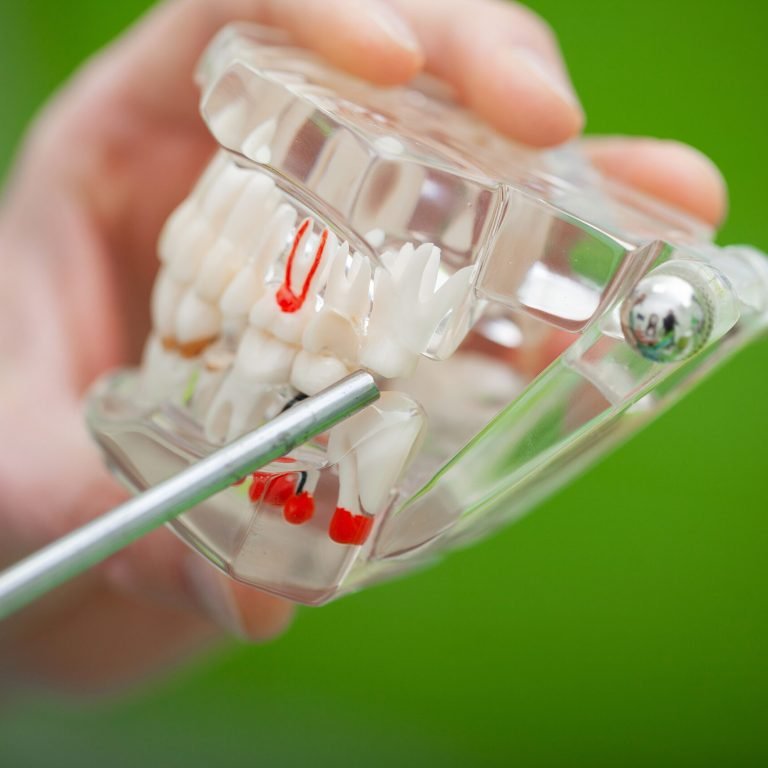 Dentist hand holding of jaw model of teeth and cleaning dental with dental tool.